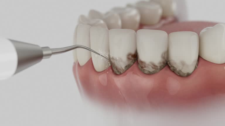 Reliable Dental Implants contractor in Salem, UT by Smile Center Dentistry